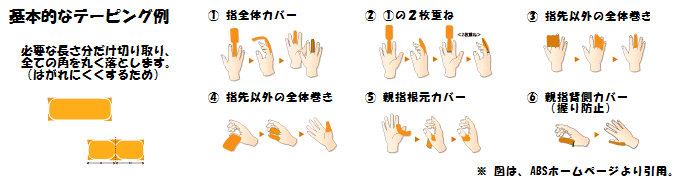 基本的なテーピング例